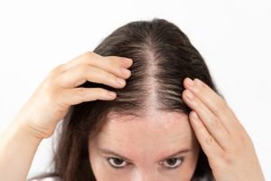 Hair Fall