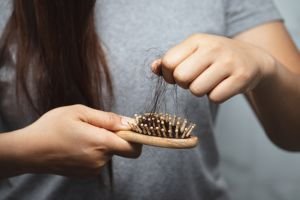 Pattern Hair Loss